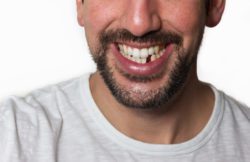Replace Your Missing Teeth in Lexington Kentucky