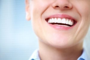 teeth cleaning in Lexington Kentucky