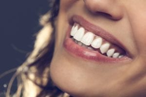 affordable dentistry in Lexington KY