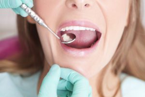 Gum Disease treatments in Lexington, Kentucky