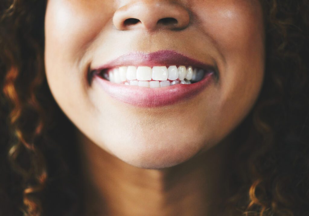 Are Porcelain Veneers Worth it?