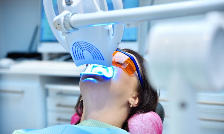 Many people find that professional teeth whitening offers more reliable, safer, and longer-lasting results. 